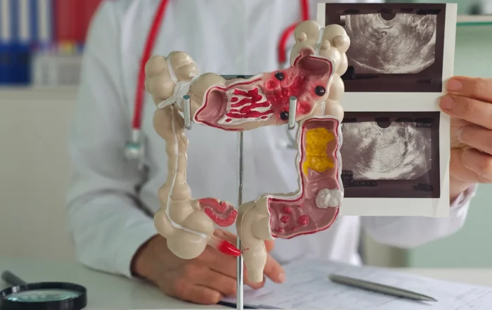Colonoscopy: What to Expect Before, During and After